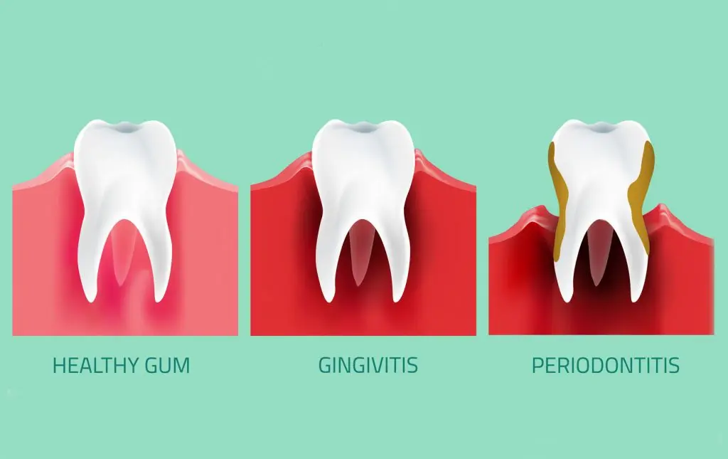 oral diseases examples