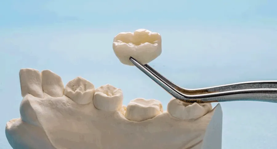 dental equipment holding tooth